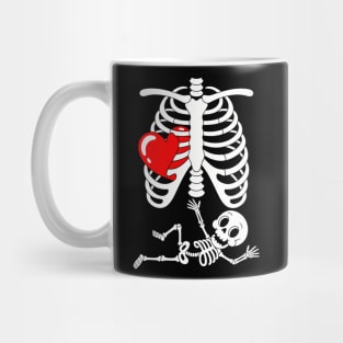 Skeleton Pregnancy Announcement XRay Mug